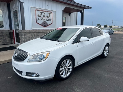 2016 Buick Verano 1SG